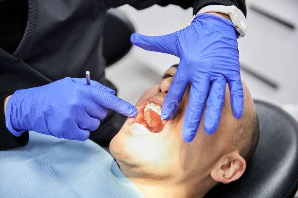 Best Emergency Wisdom Teeth Removal in Brownstown, PA